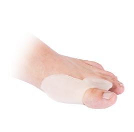 What is hallux valgus?